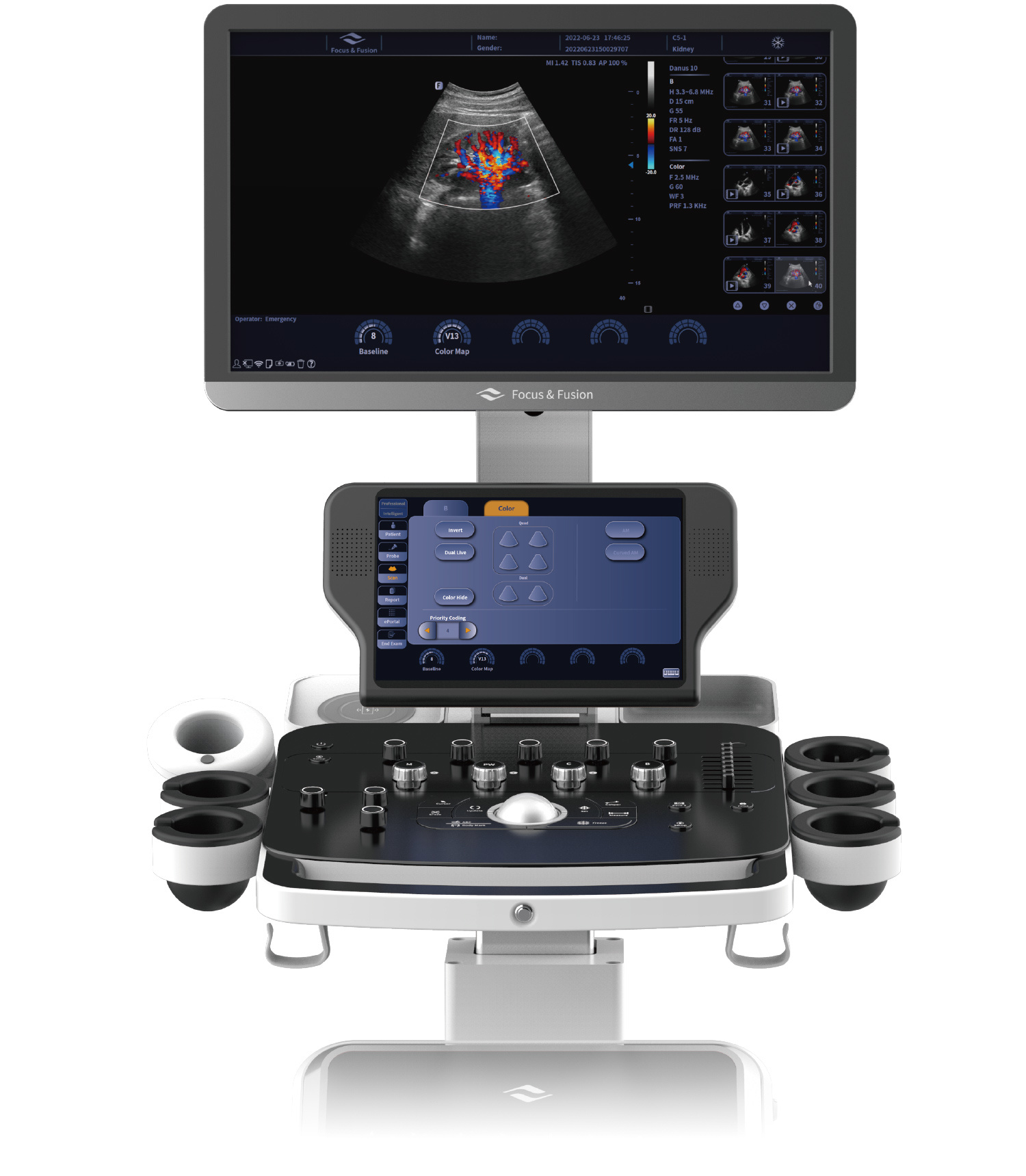 Focus & Fusion Danus 10 ultrasound system