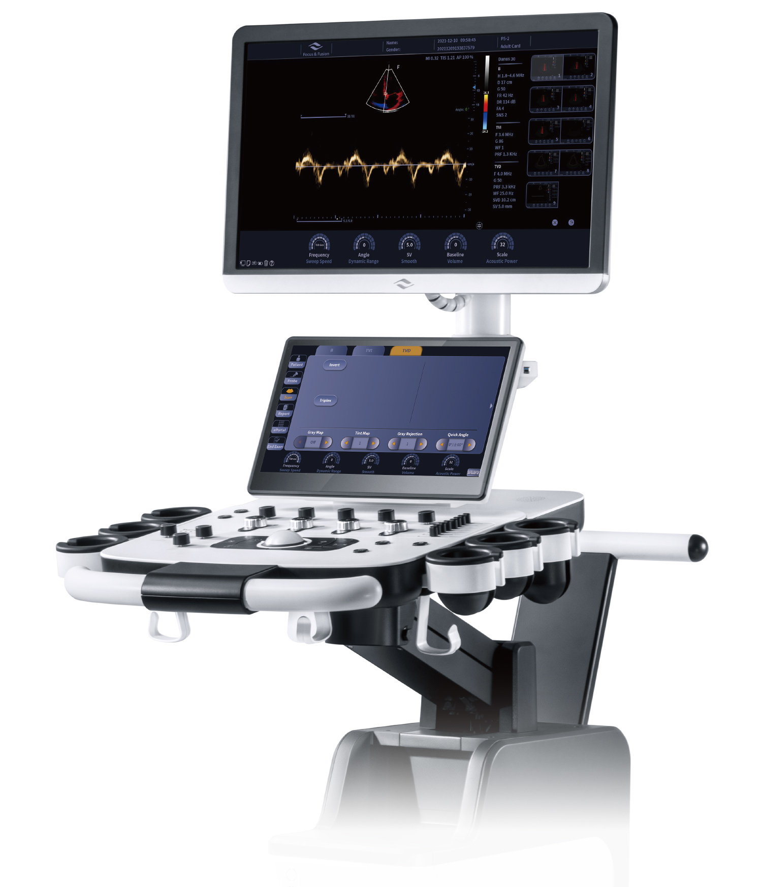 Focus & Fusion Danus 30 ultrasound system
