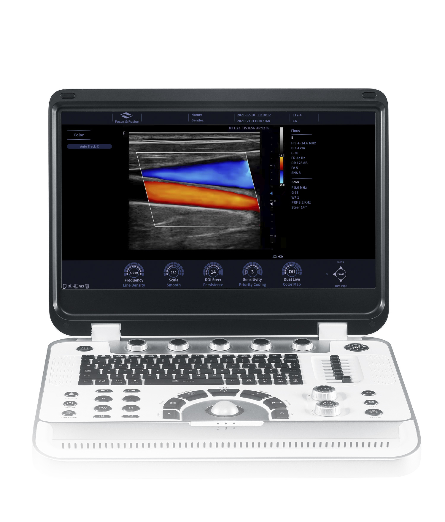 Focus & Fusion Finus 70 portable ultrasound system